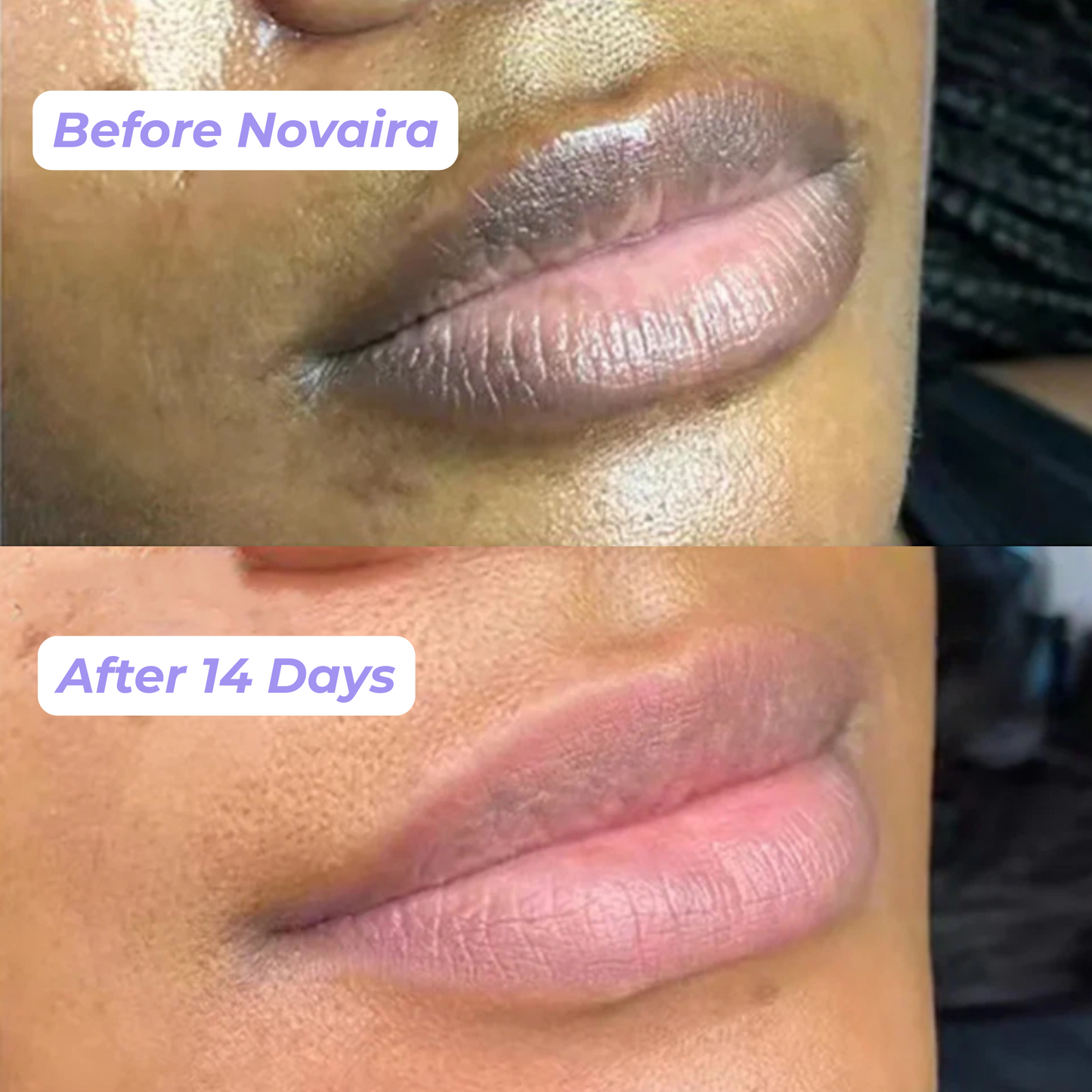 Novaira™ Lip brightening cream