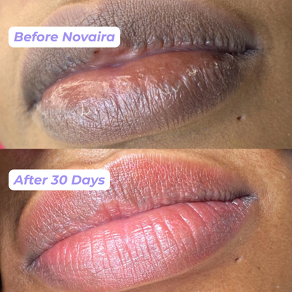 Novaira™ Lip brightening cream